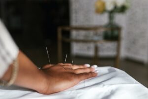Acupuncture Victoria BC